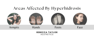 Areas affected by Hyperhidrosis - Suffolk skin clinic