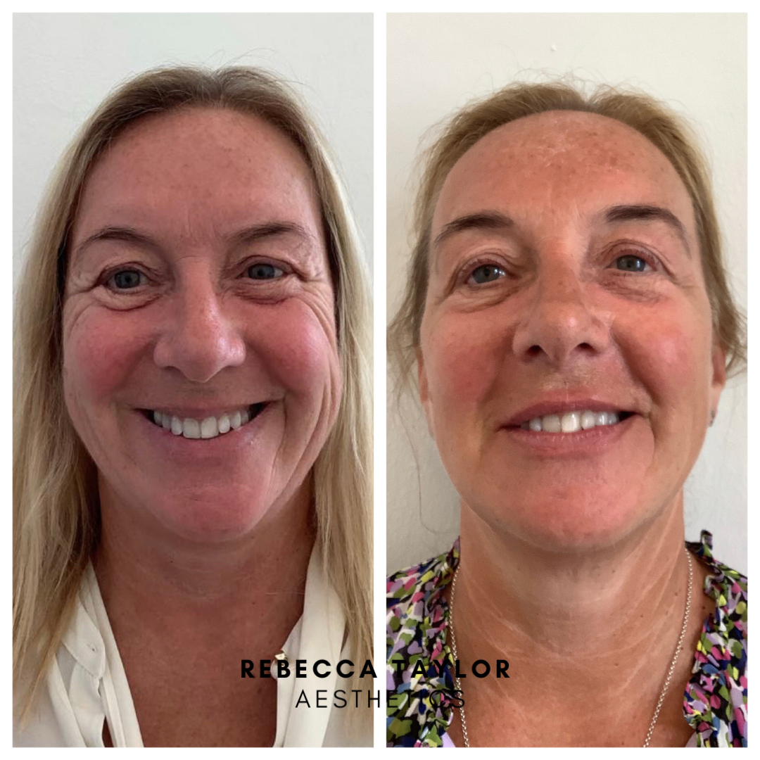 Rebecca Taylor Aesthetics Clinic in Suffolk