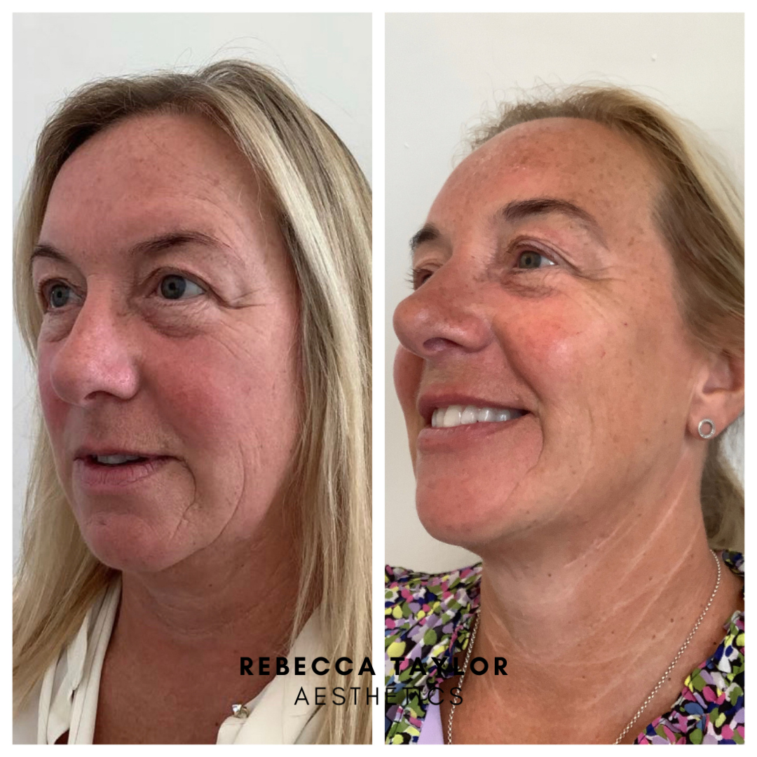 Rebecca Taylor Aesthetics Clinic in Suffolk