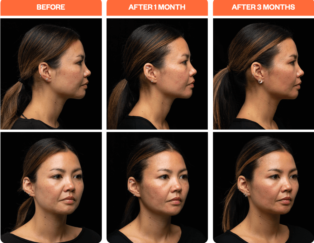 Rebecca Taylor Aesthetics Clinic in Suffolk