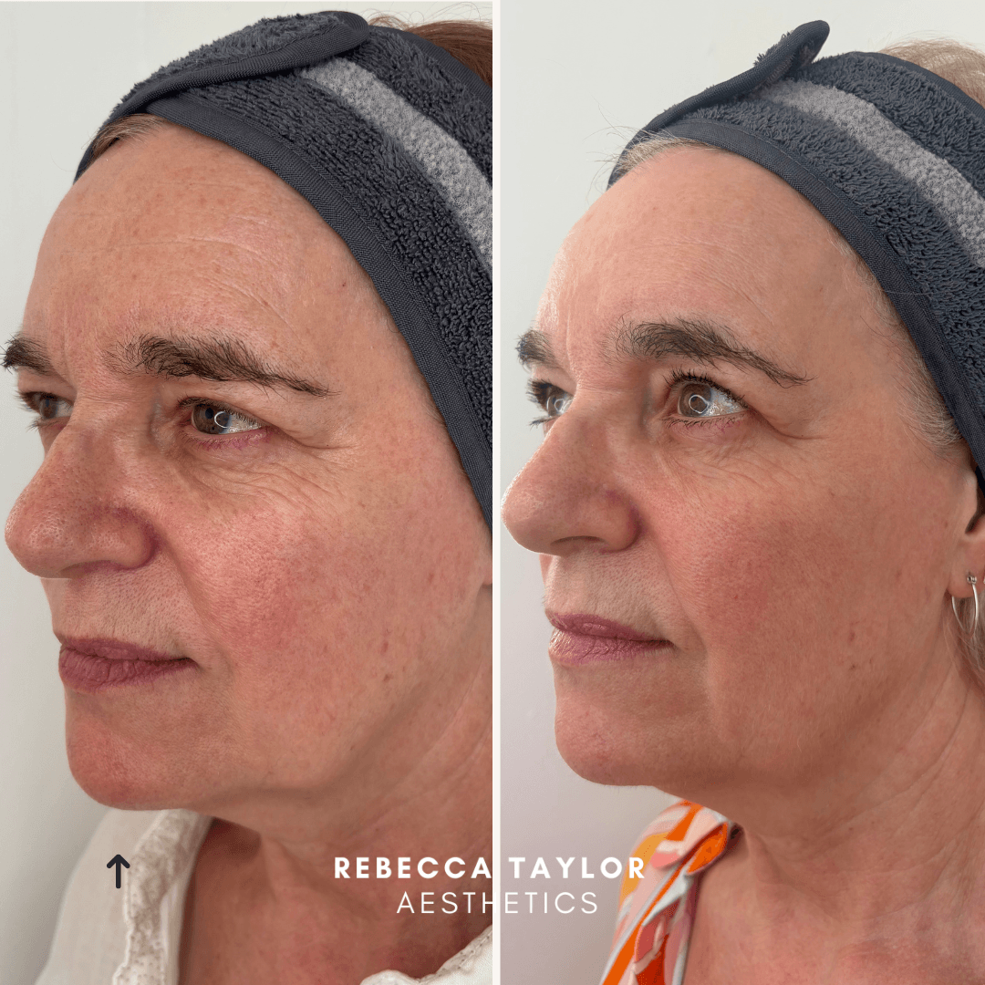Rebecca Taylor Aesthetics Clinic in Suffolk