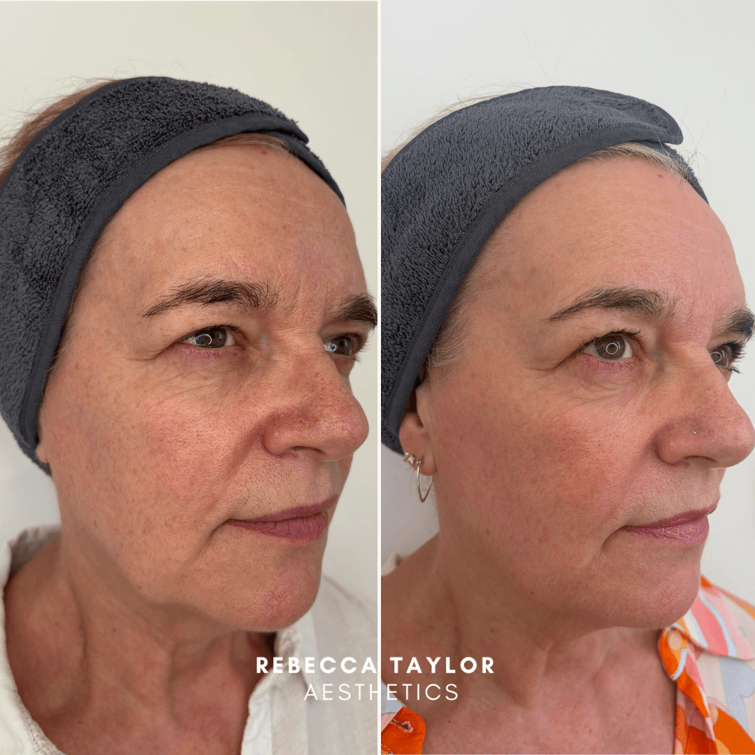 Rebecca Taylor Aesthetics Clinic in Suffolk